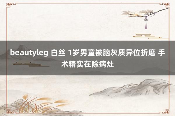 beautyleg 白丝 1岁男童被脑灰质异位折磨 手术精实在除病灶